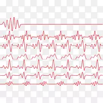 红色心率心电图监测.红色心跳线