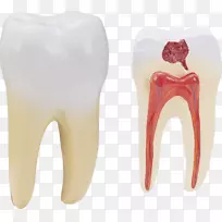 人类牙齿png图像