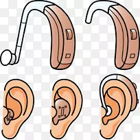 助听器.听力损失.载体耳和助听器