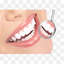 牙齿美白龋齿治疗牙医-牙医微笑PNG HD