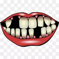 牙齿病理学蛀牙，牙科剪贴画.明亮的牙齿剪贴画