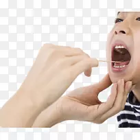 牙科口腔炎摄影-孩子正在腐烂