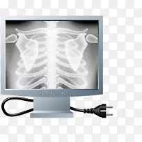 X线肋骨卡通-检查骨骼