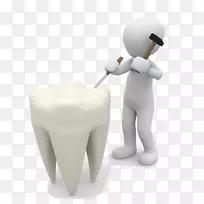 牙科学牙釉质人修复牙