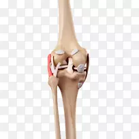 膝内侧副韧带腓骨副韧带前交叉韧带-人膝关节模型