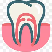 牙龈，牙科手术，根管-牙齿