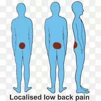 腰痛，膝痛，坐骨神经痛症状，脊柱背痛