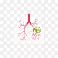 囊性纤维化肺医学诊断症状孤立性肺结节-肺