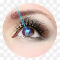 屈光手术LASIK眼科散光-眼部护理