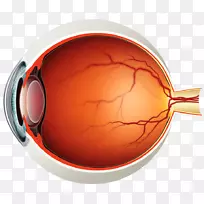 视网膜脱离玻璃体后脱离散瞳症状-眼