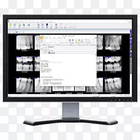 x射线视觉电脑显示器电脑软件显示装置牙科摄影-发送电子邮件按钮