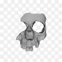 3D打印骨骼头骨-骨骼