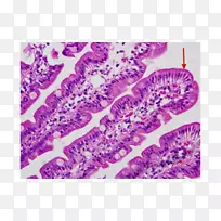 微绒毛小肠十二指肠组织学显微镜切片不规则边界