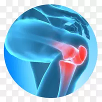 膝关节疼痛治疗疼痛管理-膝关节