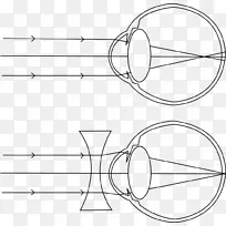 近视眼远视眼视力眼镜线图