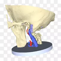 颞骨岩部解剖颈动脉管中耳模型突出
