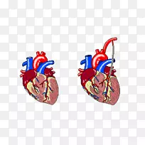 心率、心电图、心肌梗死-一捆气球