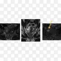 放射学医学成像医学白色磁共振成像海绵体