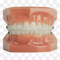人类牙齿牙套清晰对齐牙科学.牙齿模型