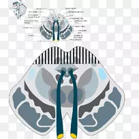 帕里诺综合征韦伯综合征凝视Benedikt综合征内侧纵束间质核延迟综合征