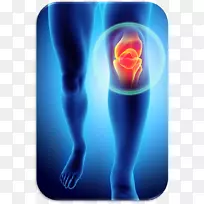 膝痛髌股痛综合征皱襞综合征损伤-膝关节骨