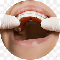 正畸学、牙科支架、牙科.牙科建筑治疗计划