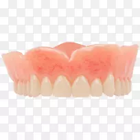 牙齿假牙、牙科种植体