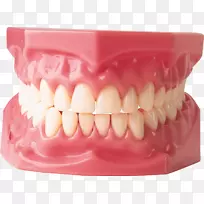 牙科美容牙龈-人类牙齿