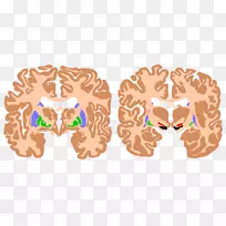 脑基底节AGY黑质神经节-脑