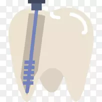 牙科牙髓治疗.健康