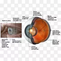 人眼视网膜