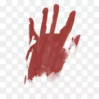Hosseini婴儿期会议血手指血