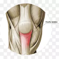 膝关节髌腱炎肌腱髌韧带