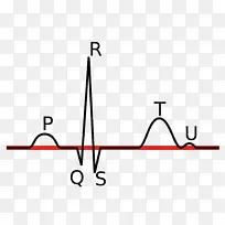 心电描记Linia izoelektrekczna p波QRs复合心率监测