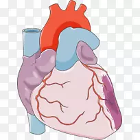 心脏冠状动脉旁路手术冠状动脉疾病心血管疾病-心脏