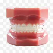 牙齿正畸牙科牙床.牙科模型