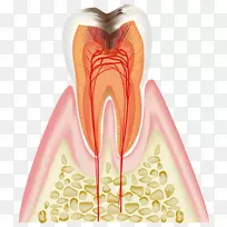 歯科牙医蛀牙牙周病龋齿