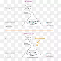 主要抑郁障碍AGY应激激素神经生物学双相障碍
