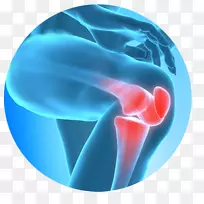 膝关节疼痛治疗疼痛管理关节疼痛手术感觉刺激疗法