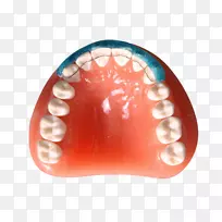 数字牙科诊断蜡