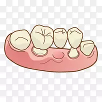牙科义齿治疗牙科手术矯正歯科桥