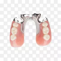 人牙义齿可摘局部义齿牙科学.白杨牙