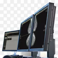 计算机监控计算机硬件医学卫生技术博士技术