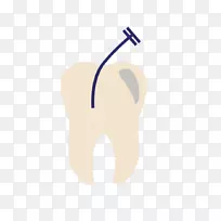 牙正畸学：克鲁奇菲尔德牙科牙套