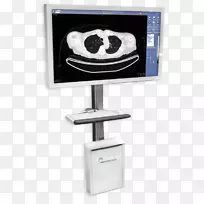 医学图片存档和通信系统放射学显示设备McKesson公司-公司