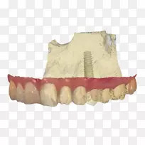 牙科实验室假牙.虚拟手术游戏