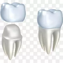 冠状美容牙科修复.修复性牙科
