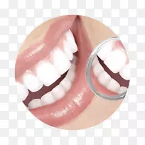 牙齿美容牙周病.修复性牙科学