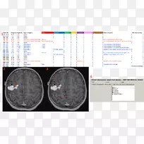 医用成像脑正电子发射断层扫描磁共振成像电极-脑