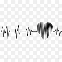 心电图心率急性心肌梗死夹心脏